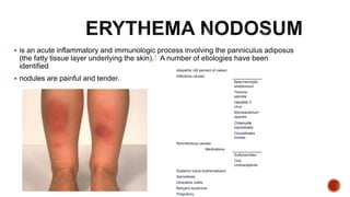 Nodular Inflamed Rash Approach to Skin rash | PPTX