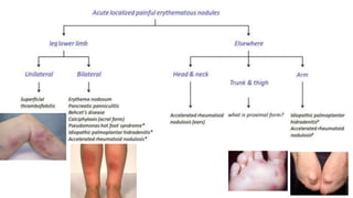 Approach to Skin rash | PPTX