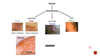 Punctiform Rash Finding Approach to Skin rash | PPTX