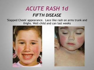 skin rash for dermatology field in medical field | PDF