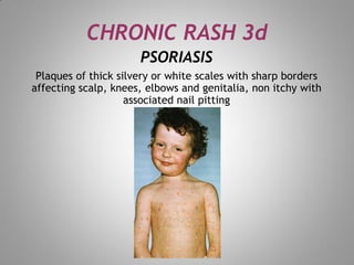 Outer Scale In Rash skin rash for dermatology field in medical field | PDF