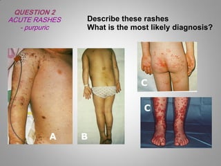 skin rash for dermatology field in medical field | PDF