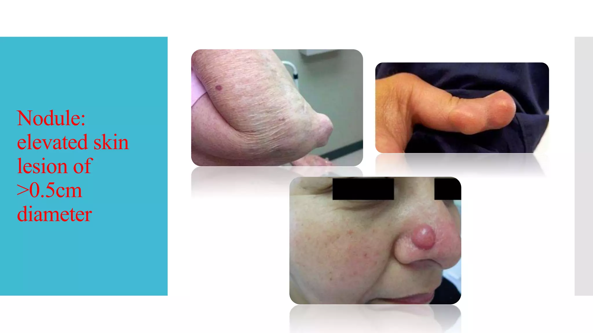 Red Flag For Rash Skin rashes red flag symptoms | PPTX