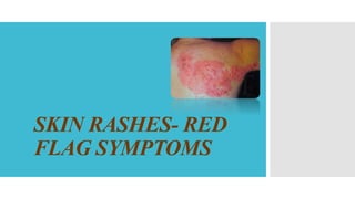 SKIN RASHES- RED
FLAG SYMPTOMS
 