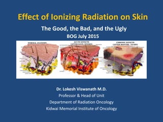 Effect of Ionizing Radiation on Skin
The Good, the Bad, and the Ugly
BOG July 2015
Dr. Lokesh Viswanath M.D.
Professor & Head of Unit
Department of Radiation Oncology
Kidwai Memorial Institute of Oncology
 