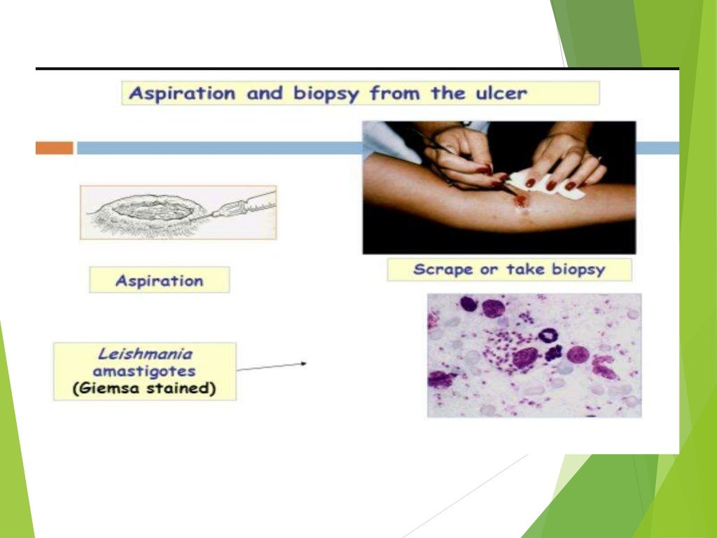 Skin scraping for diagnosis of parasitic diseases