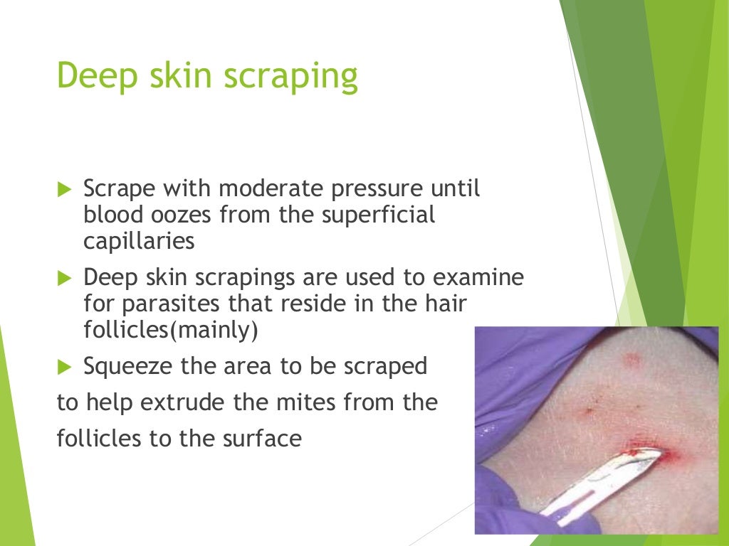 Skin scraping for diagnosis of parasitic diseases