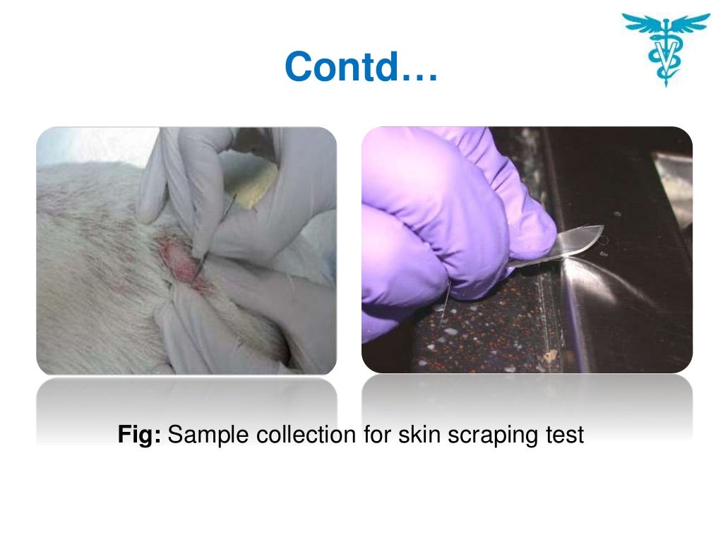 Skin scraping test