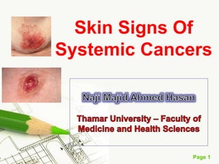 Page 1
Skin Signs Of
Systemic Cancers
 