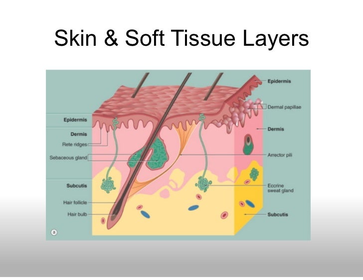 Facial Cellulitis