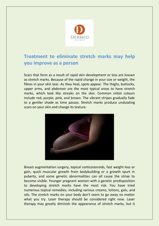 Treatment to eliminate stretch marks may help
you improve as a person
Scars that form as a result of rapid skin development or loss are known
as stretch marks. Because of the rapid change in your size or weight, the
fibres in your skin tear. As they heal, spots appear. The thighs, buttocks,
upper arms, and abdomen are the most typical areas to have stretch
marks, which look like streaks on the skin. Common initial colours
include red, purple, pink, and brown. The vibrant stripes gradually fade
to a gentler shade as time passes. Stretch marks produce undulating
scars on your skin and change its texture.
Breast augmentation surgery, topical corticosteroids, fast weight loss or
gain, quick muscular growth from bodybuilding or a growth spurt in
puberty, and some genetic abnormalities can all cause the striae to
become visible. Younger pregnant women with a genetic predisposition
to developing stretch marks have the most risk. You have tried
numerous topical remedies, including various creams, lotions, gels, and
oils. The stretch marks on your body don't seem to go away no matter
what you try. Laser therapy should be considered right now. Laser
therapy may greatly diminish the appearance of stretch marks, but it
 