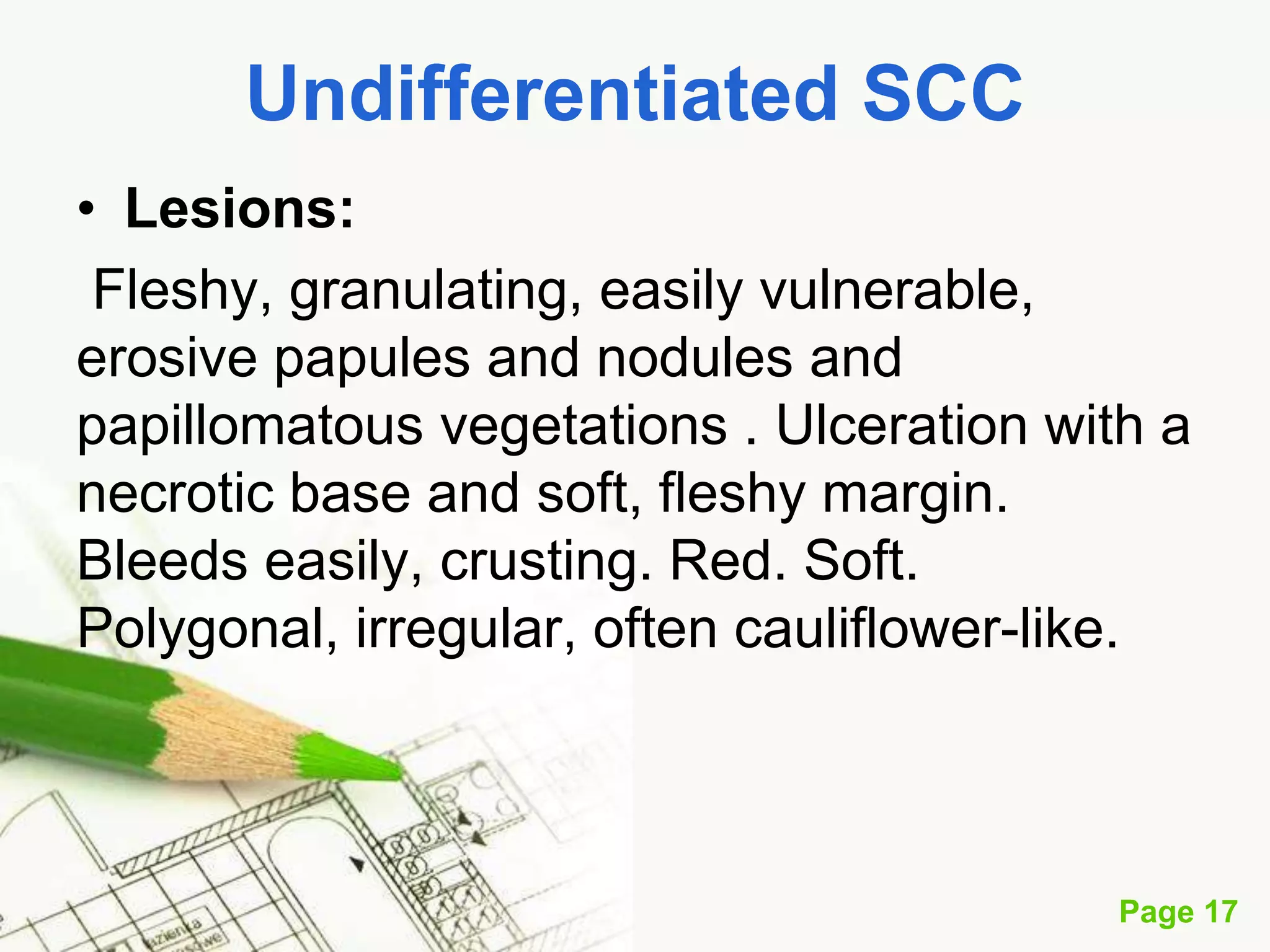 Squamous Cell Carcinoma (SCC)