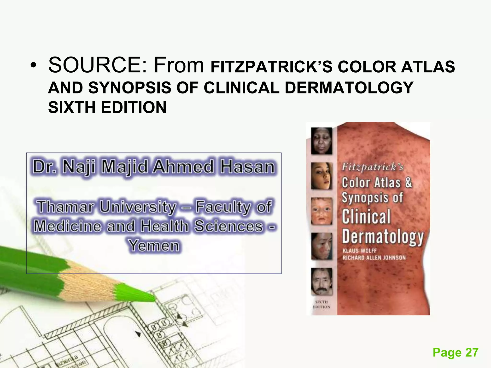 Squamous Cell Carcinoma (SCC)