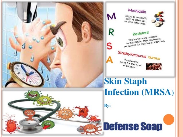 Skin Staph
Infection (MRSA)
By:
 