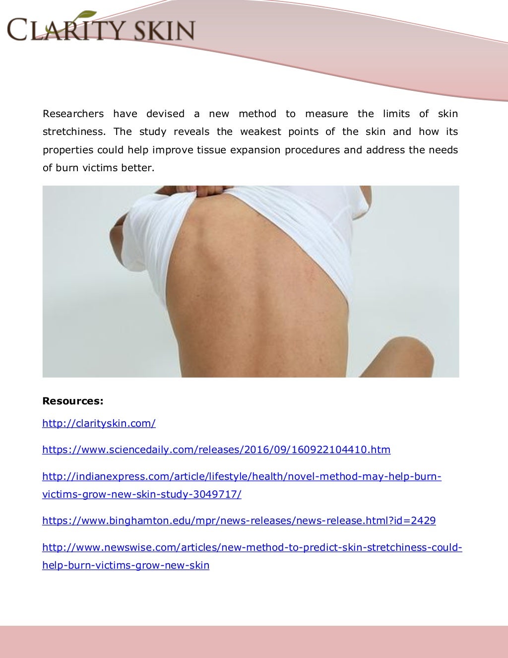 Skin stretchiness could help burn victims grow skin, a study shows