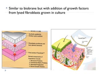  Similar to biobrane but with addition of growth factors
from lysed fibroblasts grown in culture
 
