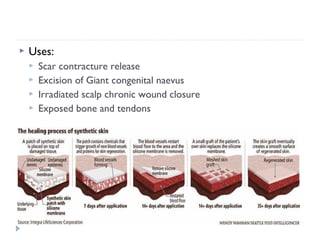  Uses:
 Scar contracture release
 Excision of Giant congenital naevus
 Irradiated scalp chronic wound closure
 Exposed bone and tendons
 