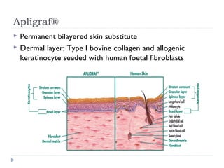 Apligraf®
 Permanent bilayered skin substitute
 Dermal layer: Type I bovine collagen and allogenic
keratinocyte seeded with human foetal fibroblasts
 