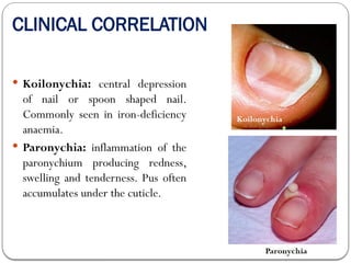 Swollen Cuticles SKIN, SUPERFICIAL FASCIA AND DEEP FASCIA.pptx