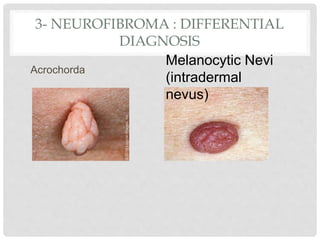 skin-swelling-pptx