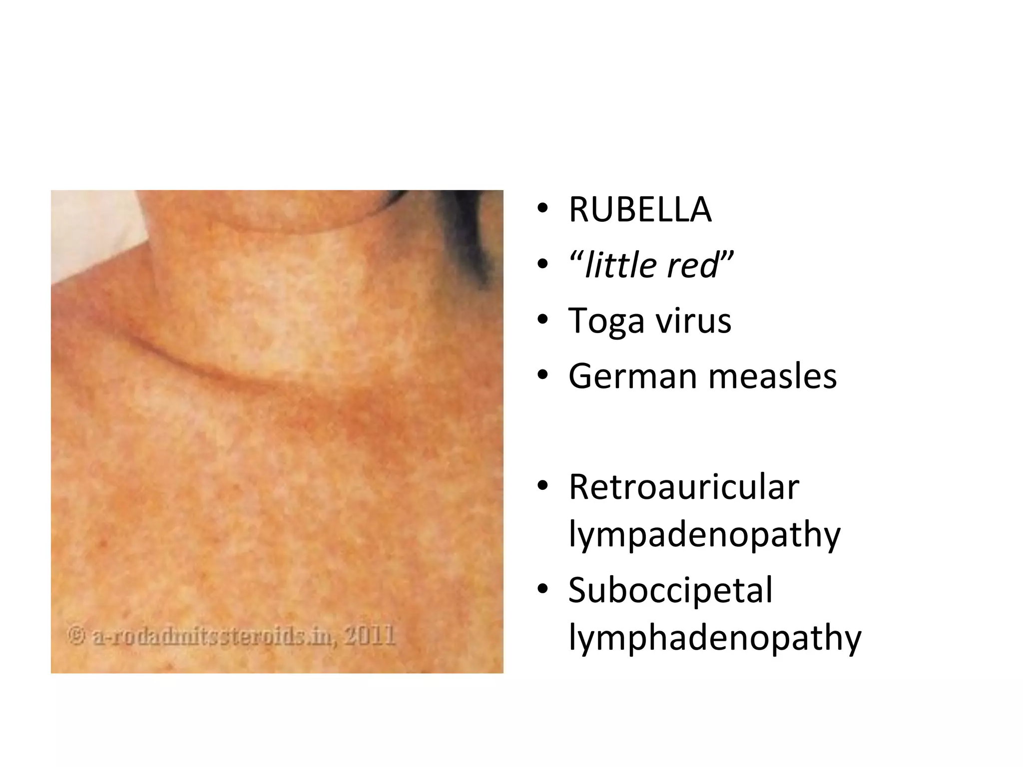 Systemic Infection Small Rash Skin systemic infections final | PDF