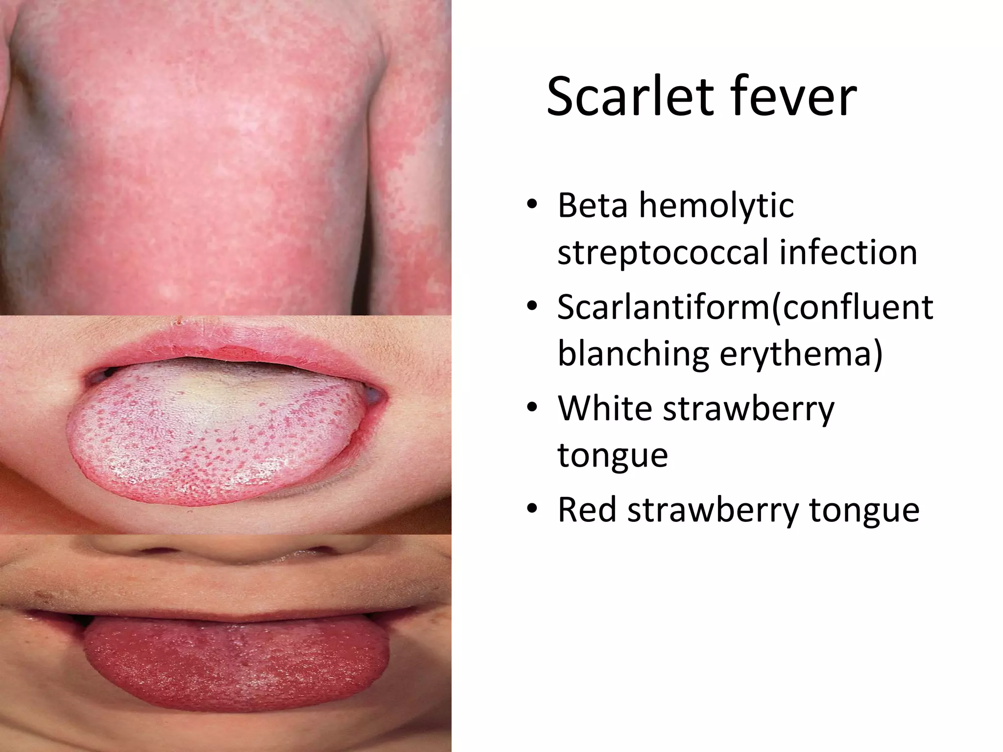 Systemic Infection Small Rash Skin systemic infections final | PDF