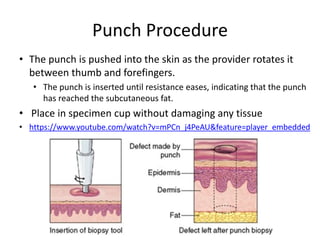 Skin Tag Removal and Skin Biopsies.pptx