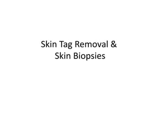 Skin Tag Removal &
Skin Biopsies
 