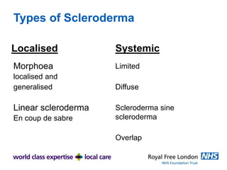 Scleroderma Types Chart Practical Skin Care | PPTX