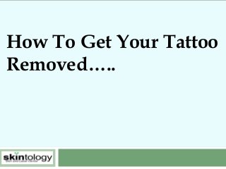 How To Get Your Tattoo
Removed…..

 