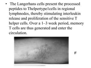 • The Langerhans cells present the processed
peptides to Thelpertype1cells in regional
lymphnodes, thereby stimulating interleukin
release and proliferation of the sensitive T
helper cells. Over a 1–3 week period, memory
T cells are thus generated and enter the
circulation.
 