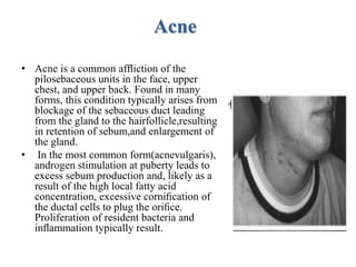 Acne
• Acne is a common afﬂiction of the
pilosebaceous units in the face, upper
chest, and upper back. Found in many
forms, this condition typically arises from
blockage of the sebaceous duct leading
from the gland to the hairfollicle,resulting
in retention of sebum,and enlargement of
the gland.
• In the most common form(acnevulgaris),
androgen stimulation at puberty leads to
excess sebum production and, likely as a
result of the high local fatty acid
concentration, excessive corniﬁcation of
the ductal cells to plug the oriﬁce.
Proliferation of resident bacteria and
inﬂammation typically result.
 