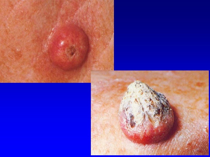 Dermatology 5th year, 1st lecture (Dr. Mohammad Yousif)