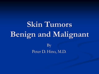 Skin Tumors
Benign and Malignant
By
Peter D. Hino, M.D.
 