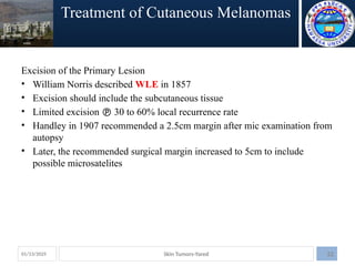 management of common skin tumors and lesions.pptx
