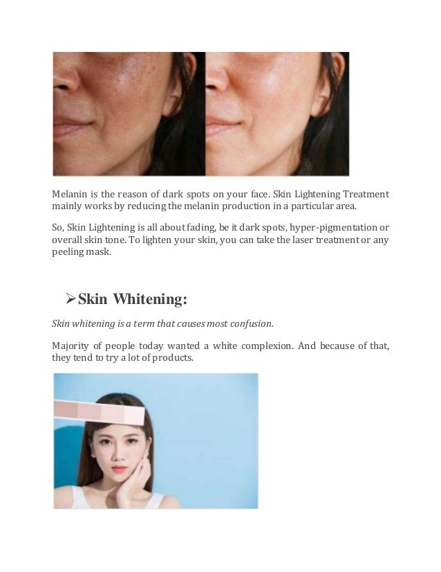 Difference between skin whitening and lightening
