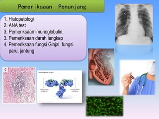 1. Histopatologi
2. ANA test
3. Pemeriksaan imunoglobulin.
3. Pemeriksaan darah lengkap
4. Pemeriksaan fungsi Ginjal, fungsi
paru, jantung
Pemeriksaan Penunjang
 