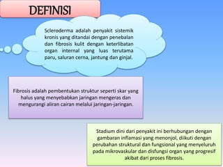 DEFINISI
Scleroderma adalah penyakit sistemik
kronis yang ditandai dengan penebalan
dan fibrosis kulit dengan keterlibatan
organ internal yang luas terutama
paru, saluran cerna, jantung dan ginjal.
Fibrosis adalah pembentukan struktur seperti skar yang
halus yang menyebabkan jaringan mengeras dan
mengurangi aliran cairan melalui jaringan-jaringan.
Stadium dini dari penyakit ini berhubungan dengan
gambaran inflamasi yang menonjol, diikuti dengan
perubahan struktural dan fungsional yang menyeluruh
pada mikrovaskular dan disfungsi organ yang progresif
akibat dari proses fibrosis.
 