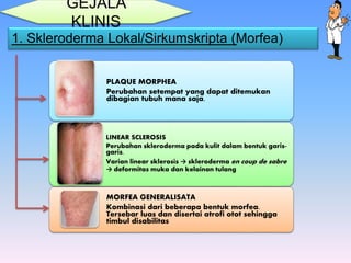 GEJALA
KLINIS
1. Skleroderma Lokal/Sirkumskripta (Morfea)
PLAQUE MORPHEA
Perubahan setempat yang dapat ditemukan
dibagian tubuh mana saja.
LINEAR SCLEROSIS
Perubahan skleroderma pada kulit dalam bentuk garis-
garis.
Varian linear sklerosis → skleroderma en coup de sabre
→ deformitas muka dan kelainan tulang
MORFEA GENERALISATA
Kombinasi dari beberapa bentuk morfea.
Tersebar luas dan disertai atrofi otot sehingga
timbul disabilitas
 