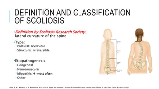 DEFINITION AND CLASSIFICATION
OF SCOLIOSIS
•Definition by Scoliosis Research Society:
lateral curvature of the spine
•Type:
• Postural: reversible
• Structural: irreversible
•Etiopathogenesis:
• Congenital
• Neuromuscular
• Idiopathic  most often
• Other
Blom, A. W., Warwick, D., & Whitehouse, M. R. (2018). Apley and Solomon’s System of Orthopaedics and Trauma Tenth Edition. In CRC Press Taylor & Francis Group
 