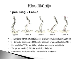 Klasifikācija
    • pēc King - Lenke




•   I – lumbāra dominante (10%); abi izliekumi krusto viduslīniju; L>TH
•   II – torakāla dominante (33%); abi izliekumi krusto viduslīniju; Th>L
•   III – torakāla (33%); lumbālais izliekums nekrusto viduslīniju
•   IV – gara torakāla (10%); L4 iesaistīts izliekumā
•   V – dubulta torakāla (10%); Th1 iesaistīts izliekumā
 