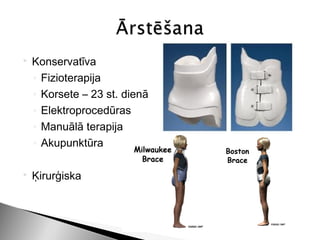    Konservatīva
    ◦ Fizioterapija
    ◦ Korsete – 23 st. dienā
    ◦ Elektroprocedūras
    ◦ Manuālā terapija
    ◦ Akupunktūra

   Ķirurģiska
 