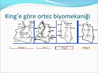 King’e göre ortez biyomekaniği
 