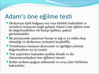 Adam’s öne eğilme testi
Skolyozun tipik bulgusu sırt veya beldeki kabarıklık ve
vertebral rotasyona bağlı gelişen Adam’s öne eğilme testi
ile değerlendirilen rib hump (gibbus, paket)
görünümüdür.
Bu pozisyonda saptanan hump ın sağ ve ya solda olup
olmadığı ve skolyozun yerleşimi kaydedilir.
Vertebranın rotasyon derecesini ve eğriliğin yönünü
değerlendiren en iyi testtir.
Test yapılırken hastadan ayaklar bitişik ve diz
ekstansiyondayken öne eğilmesi istenir.
Kollar serbest aşağıya sallanmalı ve avuç içleri birbirine
bakmalıdır.
 
