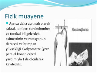 Fizik muayene
Ayrıca daha ayrıntılı olarak
sakral, lomber, torakolomber
ve torakal bölgelerdeki
asimetrinin ve rotasyonun
derecesi ve hump ın
yüksekliği skolyometre (yere
paralel konan cetvel
yardımıyla ) ile ölçülerek
kaydedilir.
 