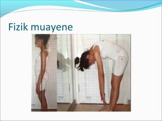 Fizik muayene
 