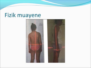 Fizik muayene
 