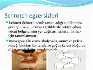 Schrotch egzersizleri
Lehnert Schroth kendi tanımladığı sınıflamaya
göre 3’lü ve 4’lü curve eğriliklerde ortaya çıkan
vücut bölgelerinin yer değiştirmesini anlatmak
için tanımlamıştır
Buna göre 3’lü curve skolyozda, omuz ve pelvis
kuşağı blokları bir tarafa ve göğüs kafesi bloğu da
diğer tarafa doğru yer değiştirir
 