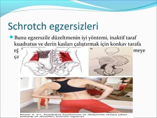 Schrotch egzersizleri
Bunu egzerszile düzeltmenin iyi yöntemi, inaktif taraf
kuadratus ve derin kasları çalıştırmak için konkav tarafa
eğilme ve diz çökme ile düzeltici pozisyonu aktive etmeye
çalışmaktır
 