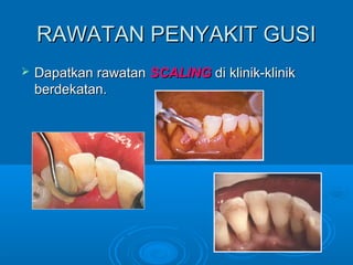 Rawatan akar gigi klinik kerajaan